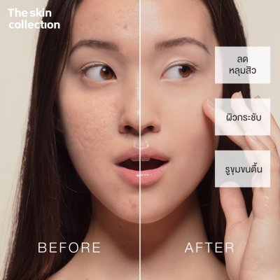 The Skin Collection Serum Copper Tripeptide 3% (30ml) เซรั่มแก้ปัญหาหลุมสิว ผิวกระชับ รูขุมขนตื้นขึ้น