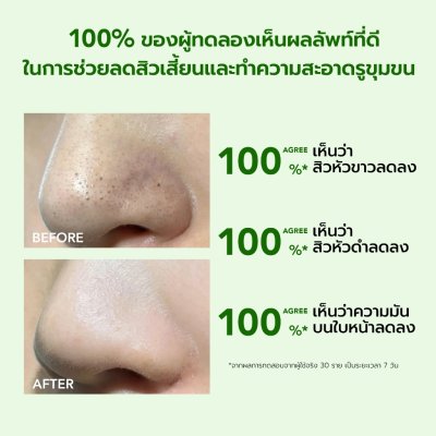 Y.O.U AcnePlus Oil Control Clay Mask (50g) วาย โอ ยู แอคเน่พลัส ออยล์ คอนโทรล เคลย์ มาส์ก