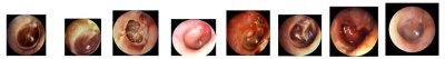 E009 หุ่นฝึกการตรวจหู  / External  Ear Examination  Model