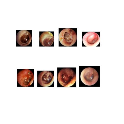 E009 หุ่นฝึกการตรวจหู  / External  Ear Examination  Model