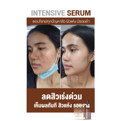  Review ผู้ใช้จริง (WINK WHITE INTENSIVE SERUM)