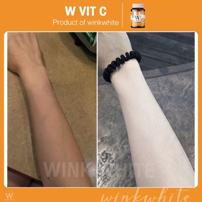  Review ผู้ใช้จริง (WINK WHITE W VIT-C)