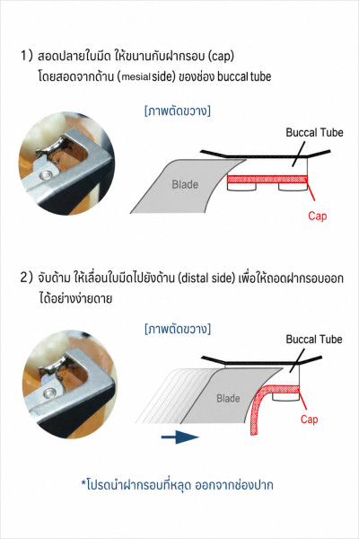 YDM Convertible Cap Removing Pliers