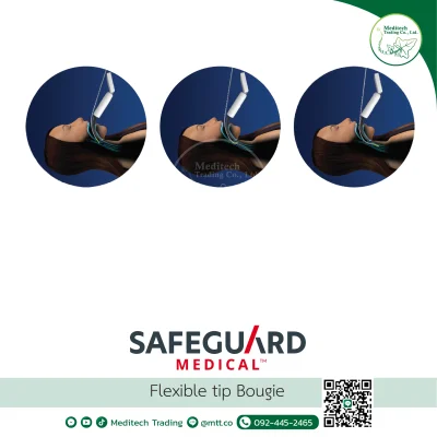 Flexible Tip Bougie (FTB)