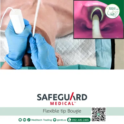 Flexible Tip Bougie (FTB)