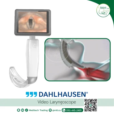 Video Laryngoscope