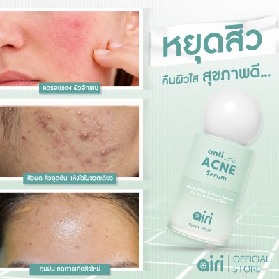 Anti Acne Serum