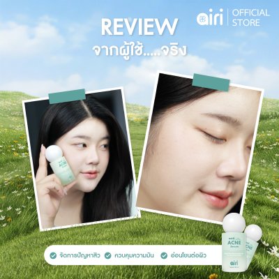Anti Acne Serum