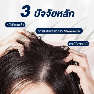 FGDG Duo Clear Anti-dandruff Shampoo Set เซ็ทแชมพูสูตรพิเศษ สำหรับผู้ที่มีปัญหารังแค ขนาด 300 มล. + 8 มล.*3 ซอง