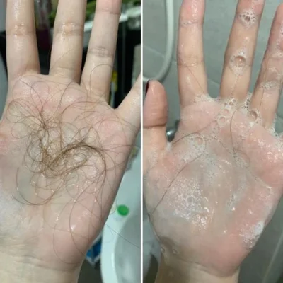 Farger Shampoo Hair Fall แชมพู อัญชัน เบซซี่ 300 มล. ลดผมร่วง
