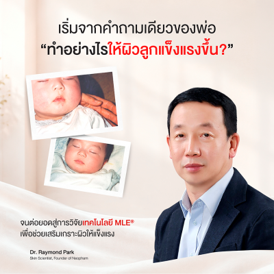 อโทปาล์ม เอ็มแอลอี ครีม 30 มล.