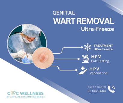 รักษาหูดหงอนไก่ด้วยการจี้เย็น (Cryotherapy) | CMC Wellness