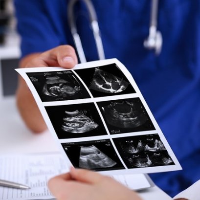 เพิ่มความน่าเชื่อถือและประสิทธิภาพสูงสุดของเครื่องพิมพ์ด้วยสื่อสิ่งพิมพ์ทางการแพทย์ของ Sony 