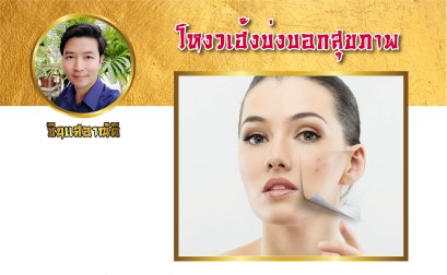 โหงวเฮ้ง บ่งบอกสุขภาพภายใน