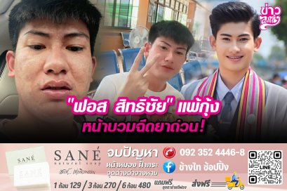 "ฟอส สิทธิชัย" แพ้กุ้ง หน้าบวมฉีดยาด่วน!