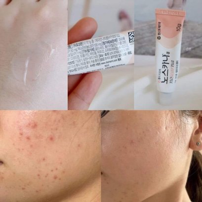 noscarna Gel 10g. หลอดเล็ก