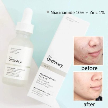 The Ordinary Niacinamide 10% + Zinc 1% 30ml.