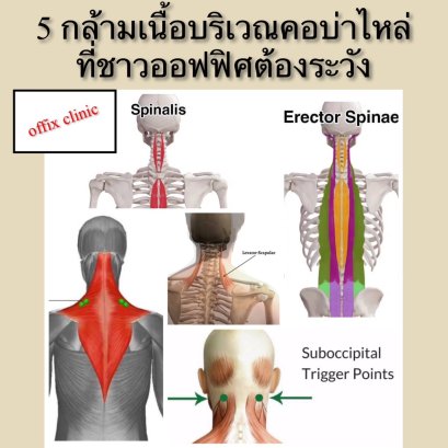  5 กล้ามเนื้อบริเวณคอบ่าไหล่ที่ชาวออฟฟิศควรต้องระวัง