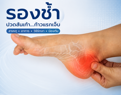 Don't Ignore Heel Pain! รู้จักโรครองช้า: สาเหตุของการปวดส้นเท้าบ่อย