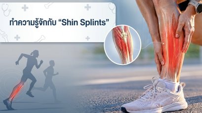 ทำความรู้จักกับโรค "Shin Splints"  