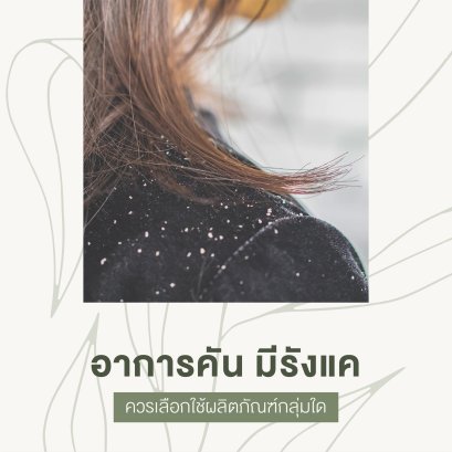 อาการคัน มีรังแค