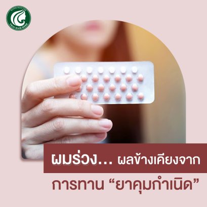 ผมร่วง ผลข้างเคียงจาก ยาคุมกำเนิด