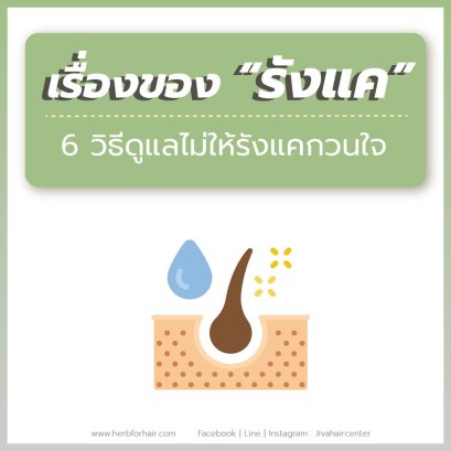เรื่องของรังแคเป็นๆหายๆ