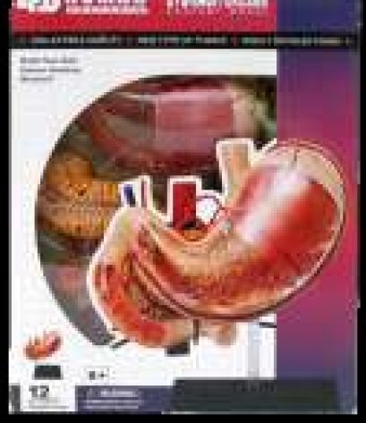 แบบจำลองช่องท้อง