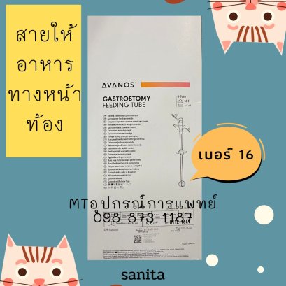 Gastrostomy tube feeding สายให้อาหารทางหน้าท้อง