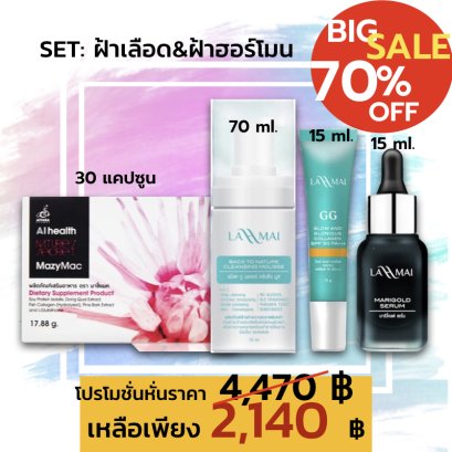 SET : ฝ้าเลือด ฝ้าฮอร์โมน