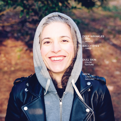 Your Skin During 20’s, 30’s, 40’s and 50’s