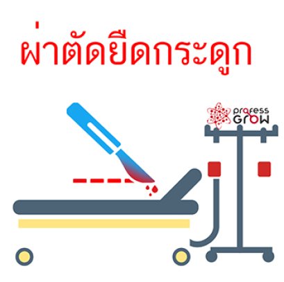 ผ่าตัดยึดกระดูกได้ไม่คุ้มเสี่ยง ผ่าตัดเพิ่มความสูงดีจริงหรือ