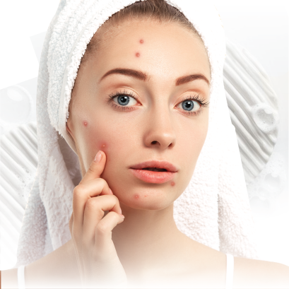สูตรสบู่ลดสิว หน้าขาวกระจ่างใส ANTI-ACNE & BRIGTENING SOAP