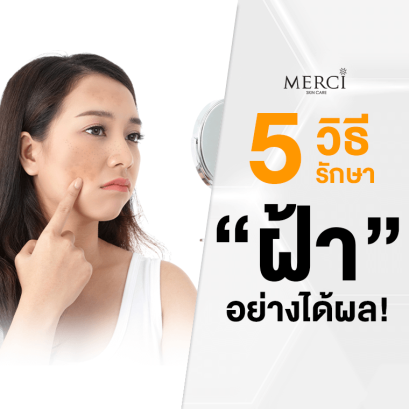 5 วิธีรักษาฝ้า กระ จุดด่างดำ อย่างได้ผล
