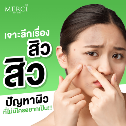 เจาะลึกเรื่องสิวสิว ปัญหาผิวที่ไม่มีใครอยากเป็น!!