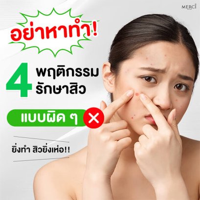 4 พฤติกรรมรักษาสิวแบบผิด ๆ ยิ่งทำสิวยิ่งเห่อ