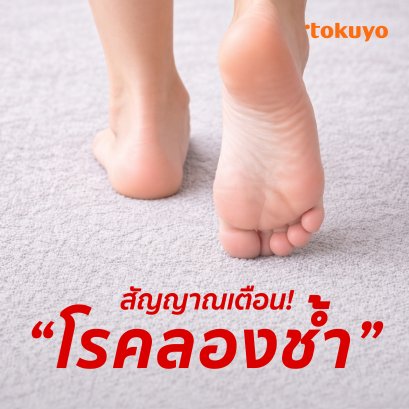 สัญญาณเตือน! โรครองช้ำ