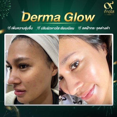 Meso Demra Glow