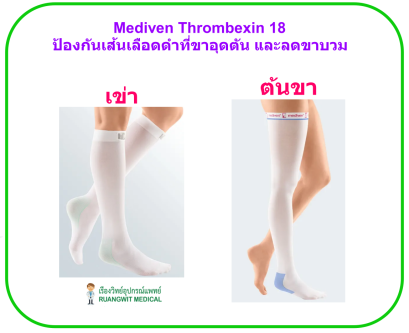 Mediven Thrombexin 18 Thigh (ต้นขา) ป้องกันการเกิดลิ่มเลือดอุดตันที่ขา และลดขาบวม
