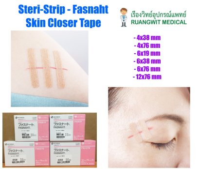 (exp 15-02-2024) Fasnaht Skin Closer Tape 6x38 mm พลาสเตอร์ปิดแผลที่ใช้แทนไหมเย็บแผล (1 ซอง)