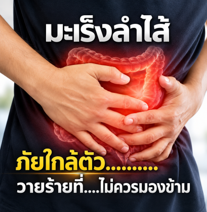 มะเร็งลำไส้