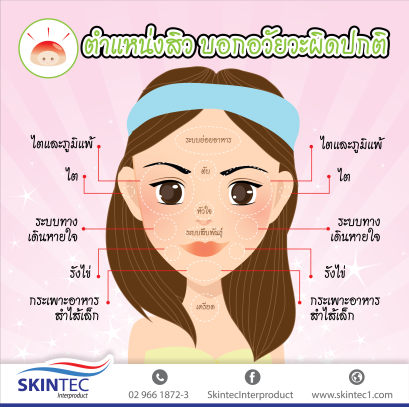 ตำแหน่งสิวบอกอาการอวัยวะผิดปกติ