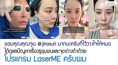 ขอบคุณคุณจูน @jirasuri มากนะครับที่ไว้วางใจให้หมอได้ดูแลปัญหาเรื่องรูขุมขนและจุดด่างดำด้วย โปรแกรม LaserME ครับผม