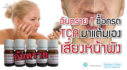 อันตราย ! ซื้อกรด TCA มาแต้มเอง เสี่ยงหน้าพัง