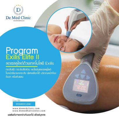 Exilis Elite II กระชับผิว กระชับสัดส่วน ลดไขมันและเซลลูไลต์ ใบหน้าเรียวยกกระชับ