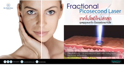 Fractional Picosecond Laser เทคโนโลยีใหม่ล่าสุด ดูแลรูขุมขนกว้าง ริ้วรอยผิวกระจ่างใส