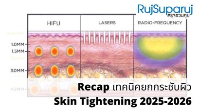 Recap เทคนิคยกกระชับผิว Skin Tightening 2025-2026