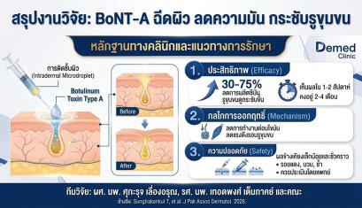 งานวิจัยทบทวน: การฉีด Botulinum Toxin Type A ในชั้นผิวเพื่อช่วยลดความมันและรูขุมขนกว้าง