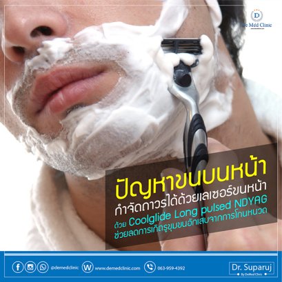 ปัญหาขนบนหน้า กำจัดถาวรได้ด้วยเลเซอร์ขนหน้า