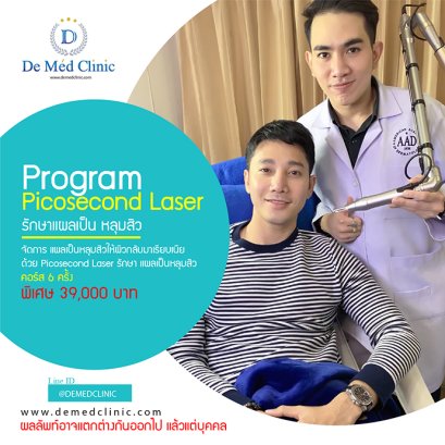 โปรแกรม Picosecond Laser รักษาแผลเป็น หลุมสิว